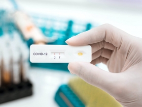 Farmacéutica Roche lanza prueba rápida de antígeno para detectar #COVID19
