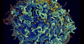 Científicos estudian ganglios linfáticos para vacuna contra VIH
